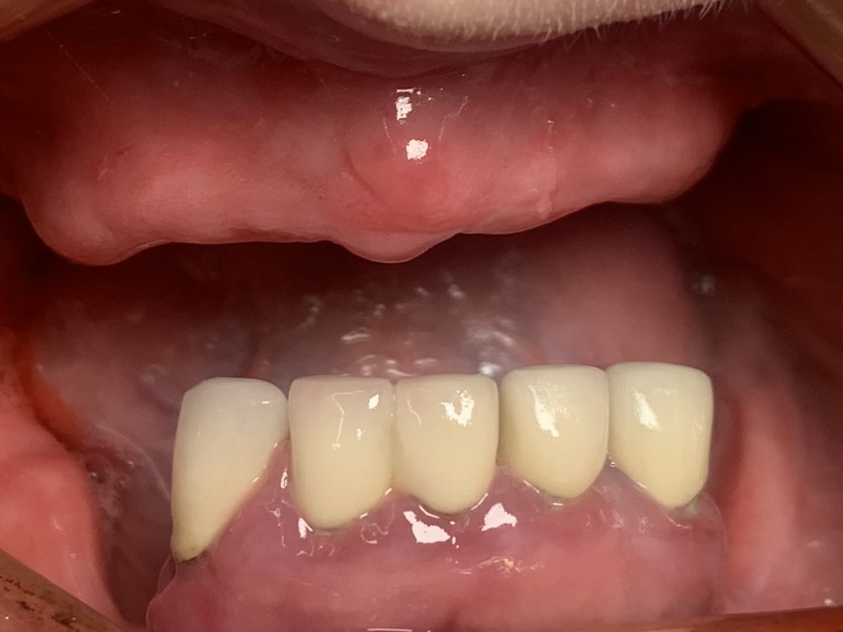 Przed leczeniem